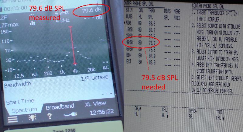 Example of tymp calibration